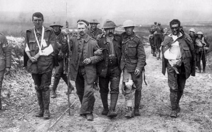 Binh sĩ Anh bị thương quay trở về từ tiền tuyến. Ảnh: Rarehistoricalphotos.