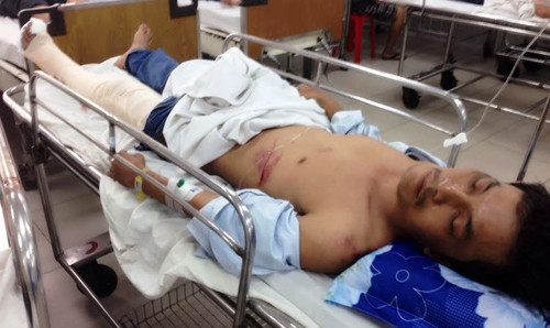 Xe Phuong Trang tong 7 xe may: Nan nhan ke giay phut kinh hoang-Hinh-2