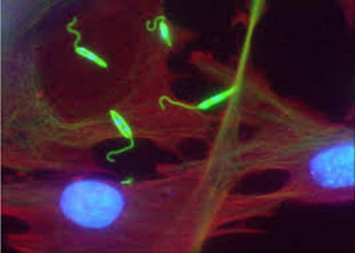 Khi không được cứu chữa kịp thời, ký sinh trùng gây kinh hoàng này sẽ tiếp tục sinh sản và phát triển, tấn công vào những tế bào, những mô lành bên cạnh, khiến vết loét ngày một lan rộng trông rất khủng khiếp.