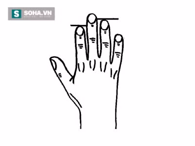 Chieu dai ngon tay 'he lo' nhung su that giat minh ve benh tat-Hinh-2