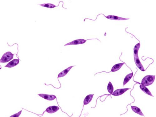 Dù có kích thước cực kỳ nhỏ bé nhưng sức tàn phá cơ thể con người của loài ký sinh trùng này khiến bất cứ ai cũng phải ghê rợn. Đáng buồn hơn, hiện các nhà khoa học vẫn chưa tìm được văcxin phòng ngừa căn bệnh này cũng như phương pháp điều trị triệt để.