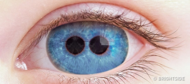  13. Mắt người có thể có nhiều hơn một con ngươi: Tật này có tên là "tật nhiều lỗ mống mắt". Người mắc tật sẽ có 2 hoặc nhiều con ngươi, nhưng thông thường chỉ có một con ngươi có vai trò thị lực mà thôi. Đây là một hiện tượng cực hiếm, có thể do gene hoặc do một căn bệnh ảnh hưởng tới mống mắt.