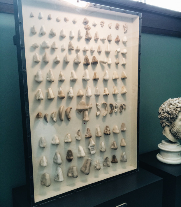 Bộ sưu tập những chiếc mũi và tai bị gãy từ các bức tượng.