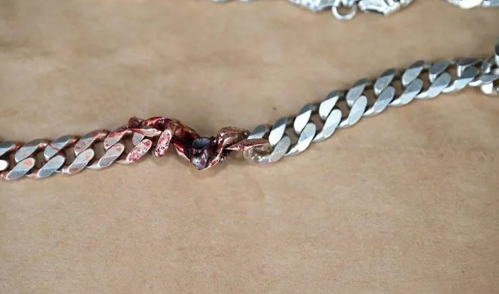 Thoát chết kỳ diệu nhờ sợi dây chuyền trên cổ Thoat chet ky dieu nho soi day chuyen tren co