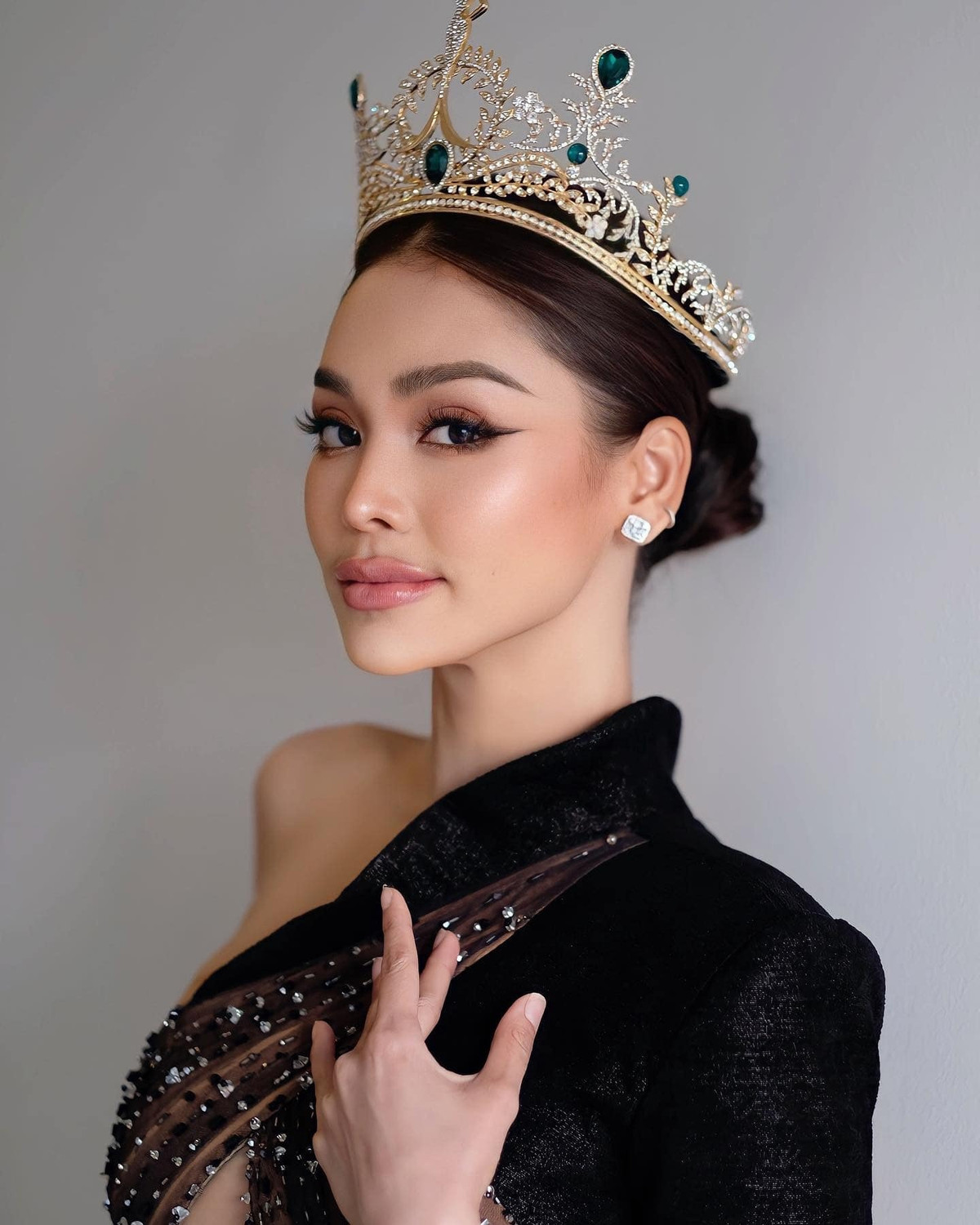 Vua dang quang, Hoa hau co nen phau thuat tham my?-Hinh-2