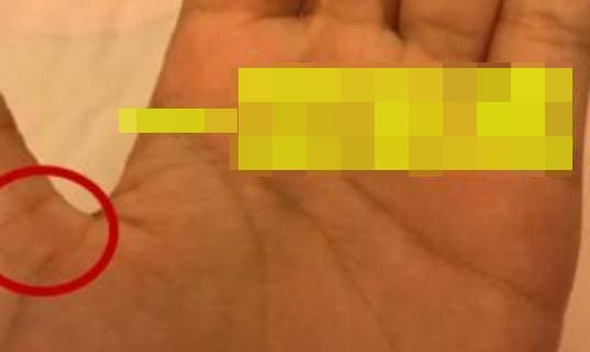  "Mắt thần": Trong tướng số nằm ở phần đầu tiên của ngón tay cái, và "Mắt thần" trông giống như con mắt là một dấu hiệu tốt lành. Nếu bạn có "mắt thần" thì xin chúc mừng, chồng tương lai của bạn không chỉ có bản lĩnh tốt mà rất có khả năng là con một gia đình giàu có. Tốt nhất là cả hai tay đều có “Mắt thần”, tay trái tượng trưng cho nửa đầu của cuộc đời, tay phải tượng trưng cho nửa sau của cuộc đời, dù chỉ có một tay cũng đã rất tốt rồi.