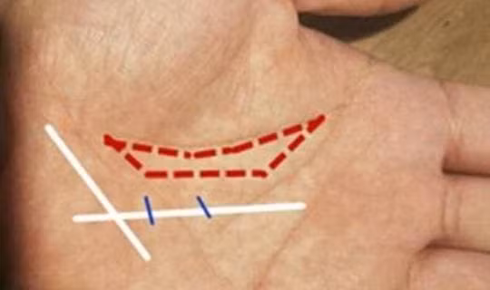 Phu nu co 'Mat than' o ngon tay cai ben phai nhat dinh giau co