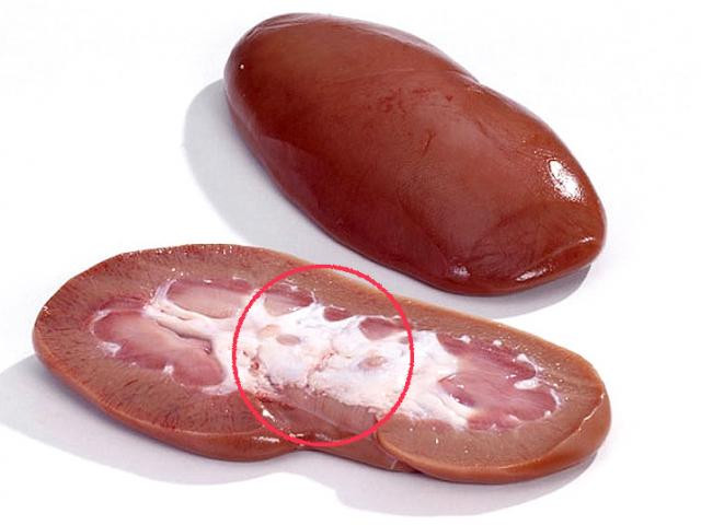 8 mon khoai khau tu thit lon can tranh neu khong muon ruoc benh-Hinh-6