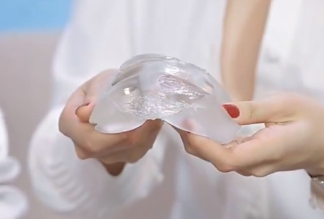 Bac si noi gi ve kha nang vo tui nguc khi di may bay?