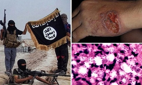 Vi khuẩn ăn thịt người có khả năng xóa sổ IS Vi khuan an thit nguoi co kha nang xoa so IS