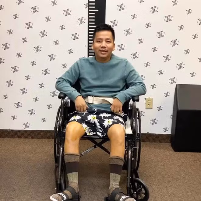 Năm 2023, Khoa Pub nhận được nhiều ý kiến trái chiều khi thông báo quyết định phẫu thuật kéo chân. Nhiều người tỏ ra khó hiểu bởi chiều cao cũ của anh là 1m67 không phải quá thấp.