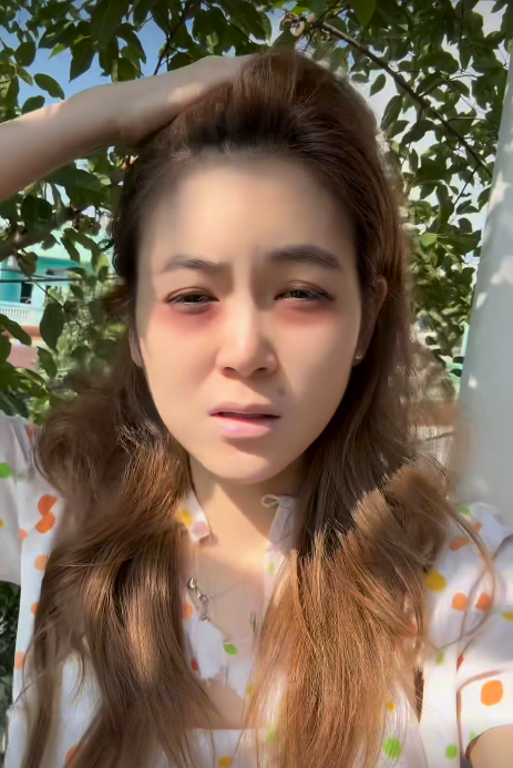 Sự xuất hiện này của Trần Trân khiến nhiều người không khỏi bất ngờ vì từ trước tới nay, cô nàng luôn đăng tải ảnh hay video với nhan sắc vô cùng xinh đẹp.