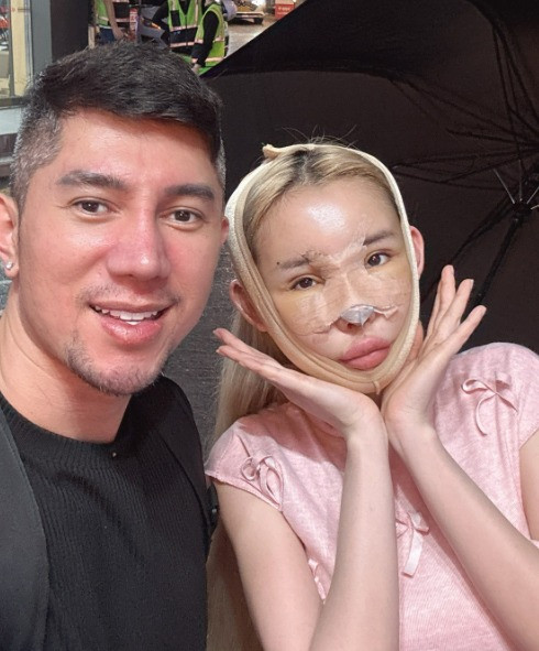 Nguyên do vì Ngân 98 đã phẫu thuật thẩm mỹ liên tục trong thời gian qua quá nhiều tới hơn 10 lần.