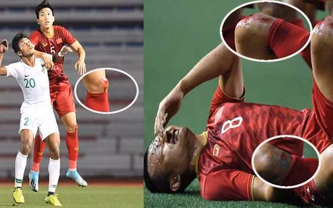 Trong 14 năm thăng trầm của mình trong màu áo đôi tuyển Việt Nam, Trọng Hoàng từng có nhiều nỗi buồn và vô vàn niềm vui.