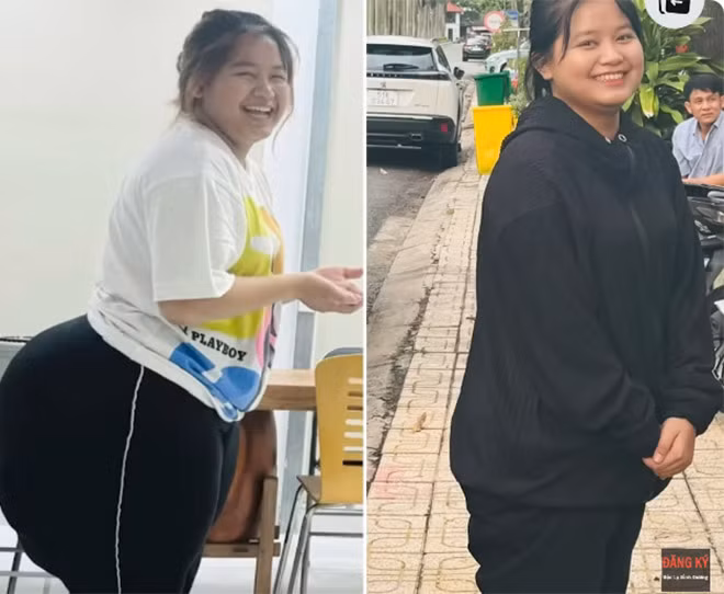 Vì chưa phục hồi hoàn toàn nên Trang đi lại nhẹ nhàng, chậm rãi. Tuy nhiên, vòng 3 của cô nhỏ đi thấy rõ, cơ thể đã cân đối hơn rất nhiều. Các bác sĩ cho biết, trong tương lai, khối u của cô bạn đến từ Kon Tum này sẽ không bị tái lại. Điều đó khiến cả gia đình chị Thúy đều rất mừng rỡ.