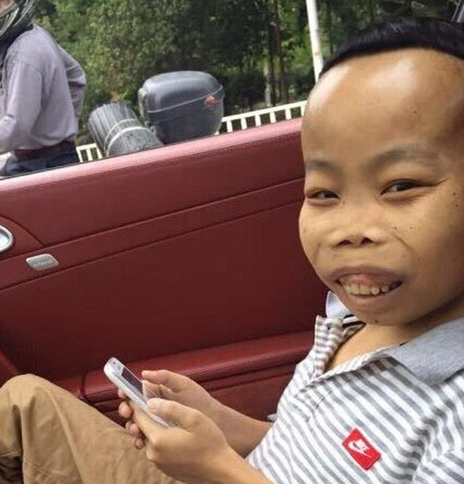 Năm 2015, cả MXH bỗng xôn xao vì sự xuất hiện của một chàng trai sở hữu ngoại hình xấu lạ. Đó chính là đại gia Trần Sơn (SN 1993), nguyên quán Quảng Đông (Trung Quốc).