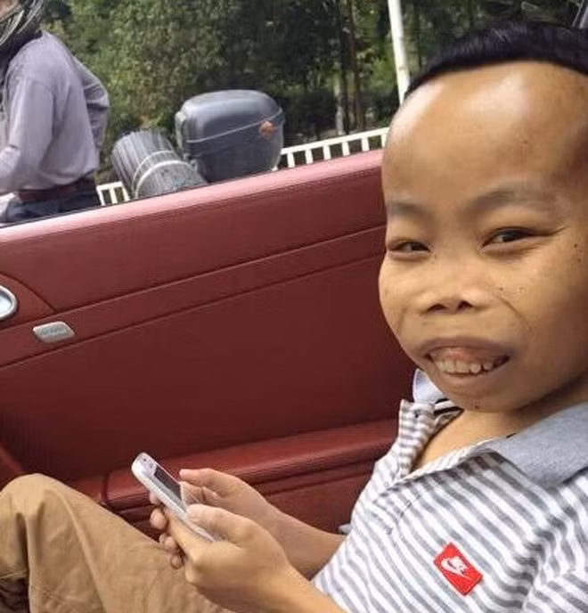 Năm 2015, cả MXH bỗng xôn xao vì sự xuất hiện của một chàng trai sở hữu ngoại hình xấu lạ. Đó chính là đại gia Trần Sơn (SN 1993), nguyên quán Quảng Đông (Trung Quốc).