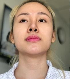 Ngoài ra, vòng 1 cũng được bà Tưng thừa nhận chính sửa 2 lần.