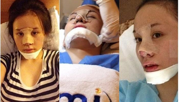 Để có được nhan sắc như hiện tại, bà Tưng đã trải qua hàng loạt phẫu thuật thẩm mỹ như thu nhỏ hai bên hàm, độn cằm, chỉnh sửa lại mũi, bọc sụn, thu nhỏ đầu mũi, cánh mũi.