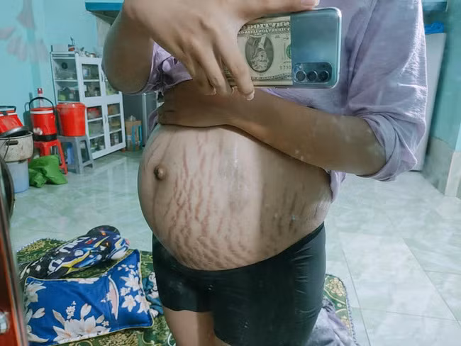 Hoi chi em khoe anh bung bau nut nguoi, nhin ma xot xa