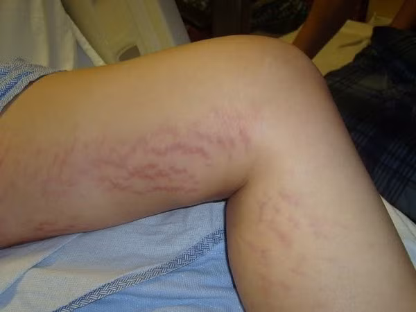 Thời điểm lúc gần sinh, chị C. xuất hiện các hiện tượng buồn nôn và cả ngày chỉ có thể ăn được mì gói. Những dòng tâm sự của mẹ bầu khiến người khác cảm động, xót xa.