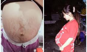 Bên cạnh đó, nhiều chị em còn học hỏi kinh nghiệm, chỉ nhau những mẹo giúp làn da đẹp hơn khi mang bầu. Nhiều người cũng nhận định, là phụ nữ thì khi mang bầu cũng phải đẹp.