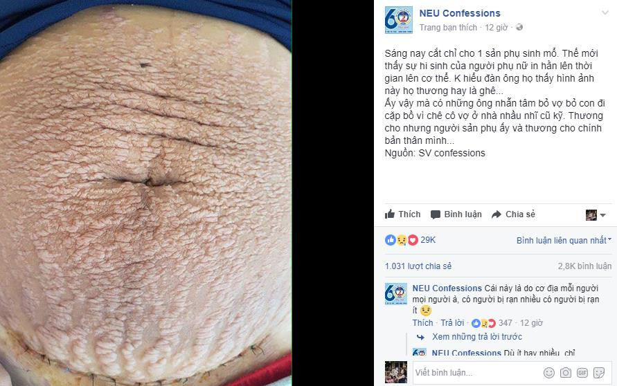 Mọi người liên tục để lại bình luận động viên mong chị C. mạnh mẽ vượt cạn thành công. Cư dân mạng còn được dịp chia sẻ những câu chuyện của mình, việc rạn da, chân tay tê mỏi, chuột rút… là điều thường xuyên xảy ra với các mẹ bầu.