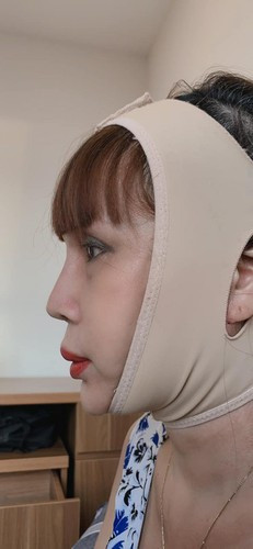 Hiện tại, nhan sắc của Thu Sao thì vẫn là chủ đề nhiều người bàn tán bởi sau khi tháo băng mặt, có vẻ như mọi thứ vẫn chưa thể trở lại trạng thái bình thường, nhất là khuôn miệng vẫn méo và chưa được tự nhiên.