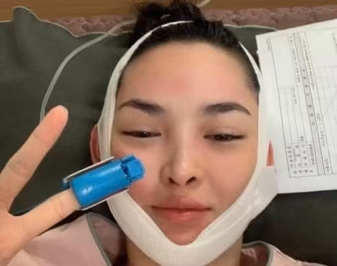 Năm 2014, gái xinh Vũ Thanh Quỳnh tham gia chương trình Change Life và nhận được suất phẫu thuật thẩm mỹ tại Hàn Quốc. Từ đây, cuộc sống của cô như "bước sang trang mới".