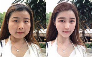 2 bức ảnh chứng minh độ quan trọng của một chiếc cằm đẹp.