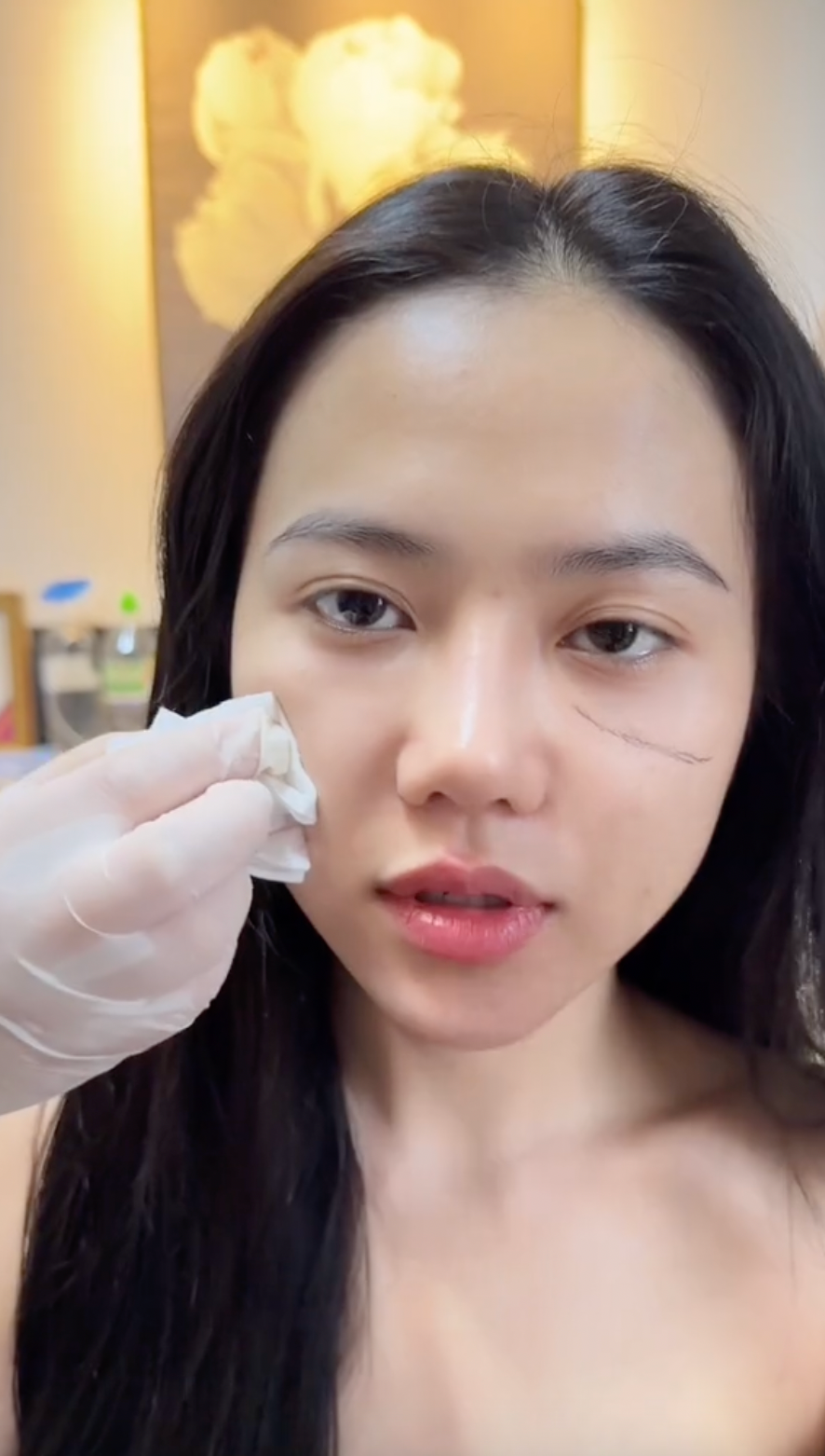 Đương nhiên những thông tin về Bò Chảnh cũng được netizen tìm hiểu kỹ càng và một trong số đó là chuyện chỉnh sửa nhan sắc. Không để dân mạng phải tò mò, chính nữ TikToker đã nhiều lần công khai việc nhờ cậy thẩm mỹ để xinh đẹp hơn.