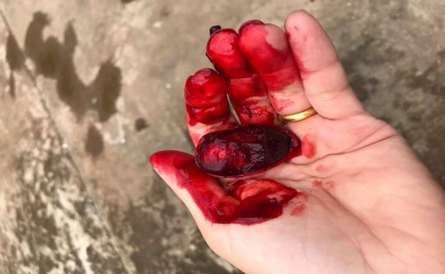 Loại trái cây này được gọi là “quả máu” do thịt quả có màu đỏ tươi và đặc sánh y như máu.