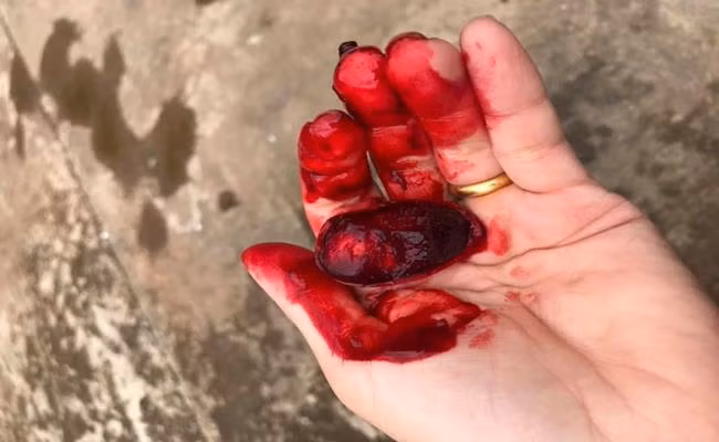 Loại trái cây này được gọi là “quả máu” do thịt quả có màu đỏ tươi và đặc sánh y như máu.