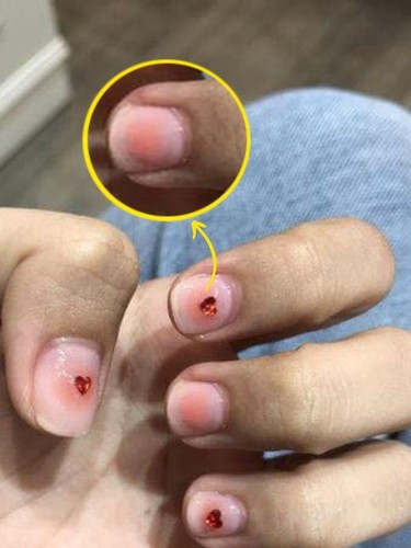 Nhìn vào hình ảnh cô nàng đăng tải có thể thấy, bộ nail trên được làm khá sơ sài. Nhìn vào tay có thể thấy, cô nàng chưa được nhặt da, form giữa các ngón tay nhìn không đều nhau, mỗi cái một kiểu.