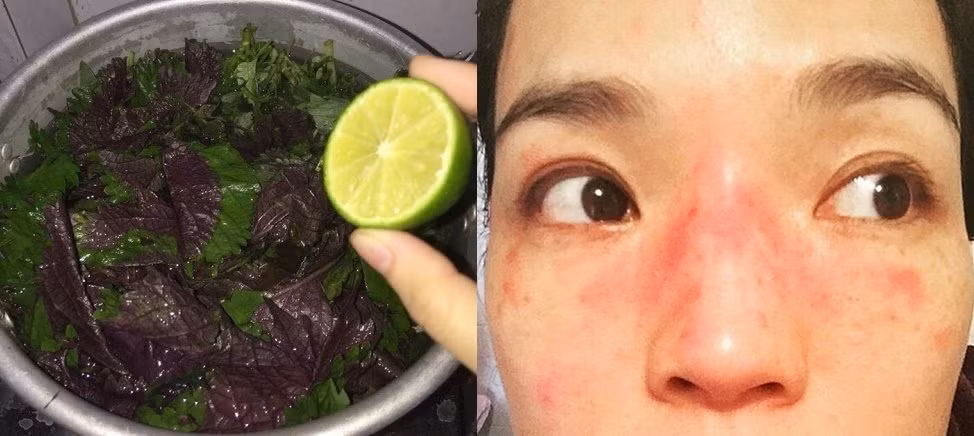 Sai lam khi lam dep da bang la tia to, loi bat cap hai-Hinh-3