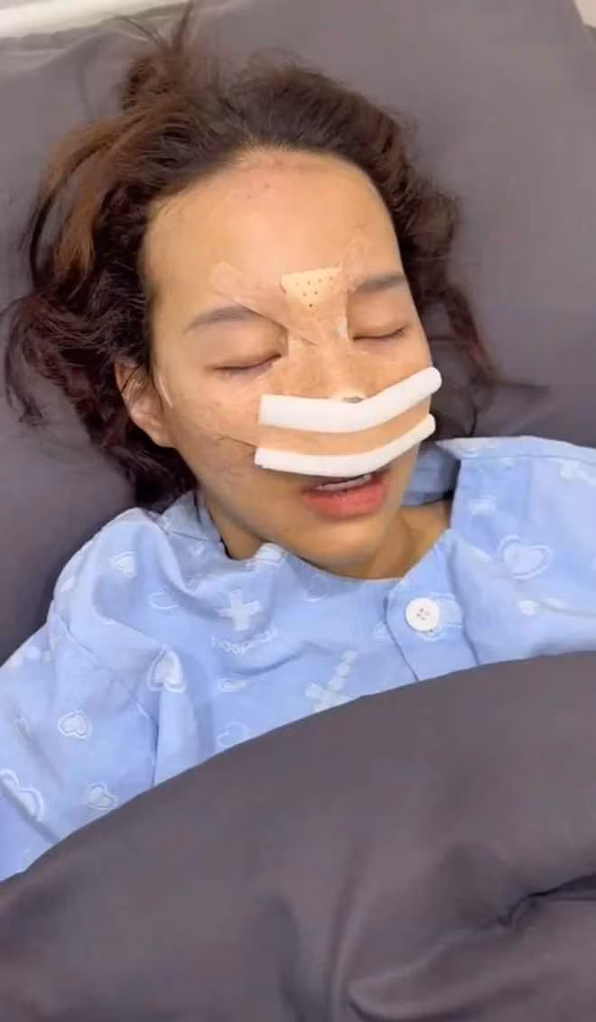 Mới đây, hot girl Gen Z gây bất ngờ hơn khi công khai quá trình phẫu thuật thẩm mỹ. Cụ thể, cô nàng sang Hàn Quốc để sửa mũi.