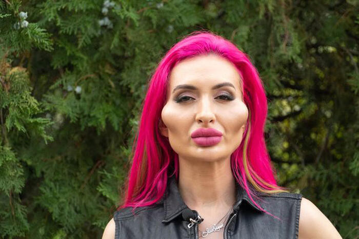 Theo nhiều người, họ cảm giác sợ khi nhìn Anastasia bởi gương mặt có phần biến dạng của cô.