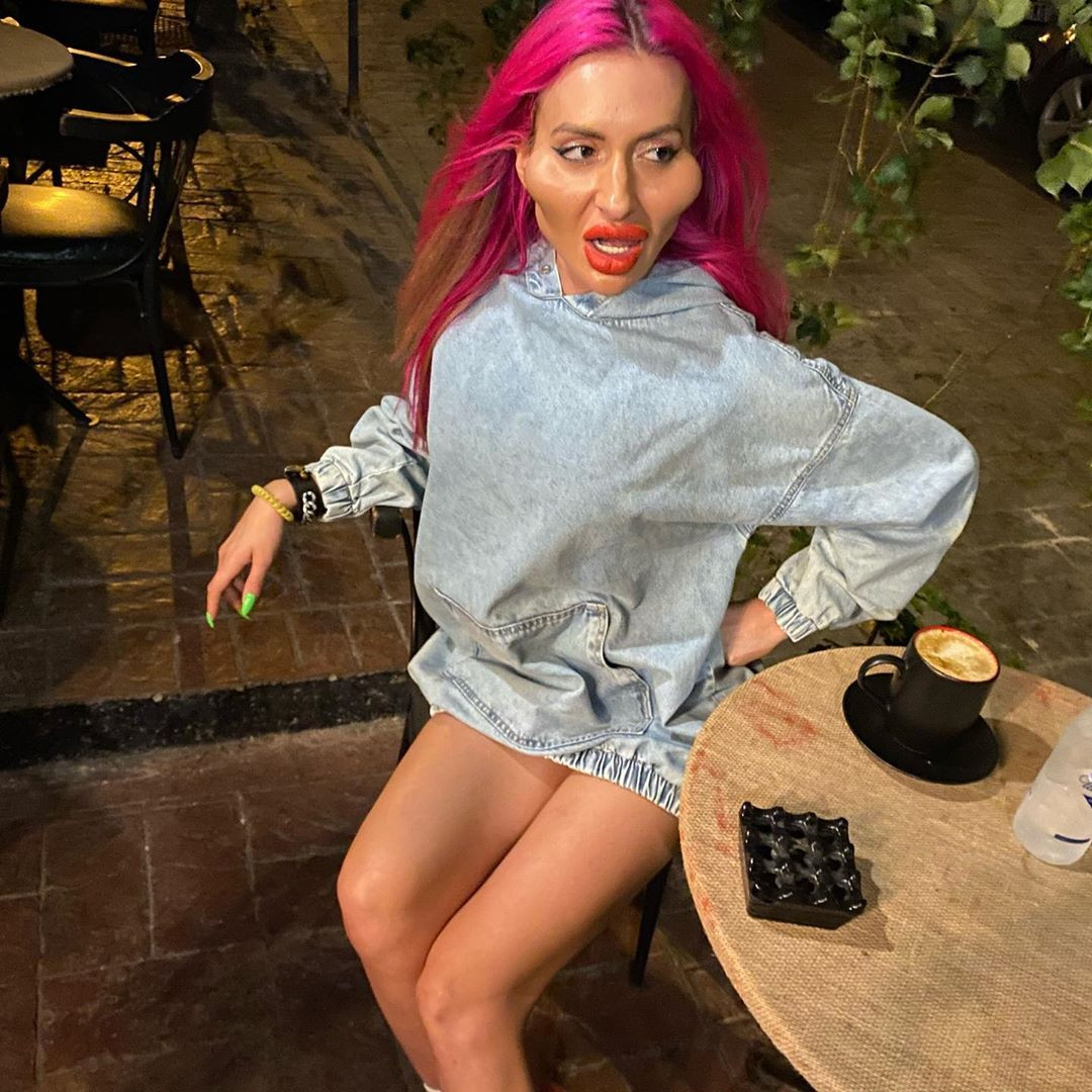 Cách đây ít lâu, Anastasia xuất hiện trên một show truyền hình. Người mẫu Ukraine thừa nhận ngày trước mình đã nóng vội trong việc chỉnh trang nhan sắc.