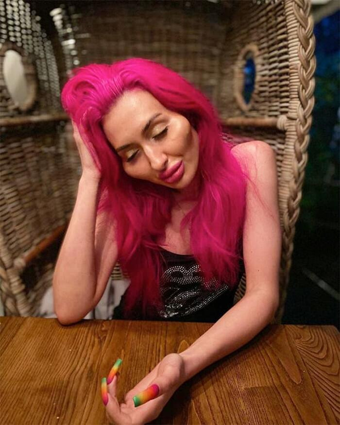 Đầu tư kinh phí lớn để làm đẹp nhưng Anastasia lại hứng chịu không ít "gạch đá", thay vì những lời khen vì màn tiêm filler quá đà của mình.