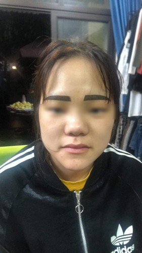 Tệ hơn là điều này còn ảnh hưởng tới công việc của họ khi ai cũng chê “lông mày nhìn sợ”.