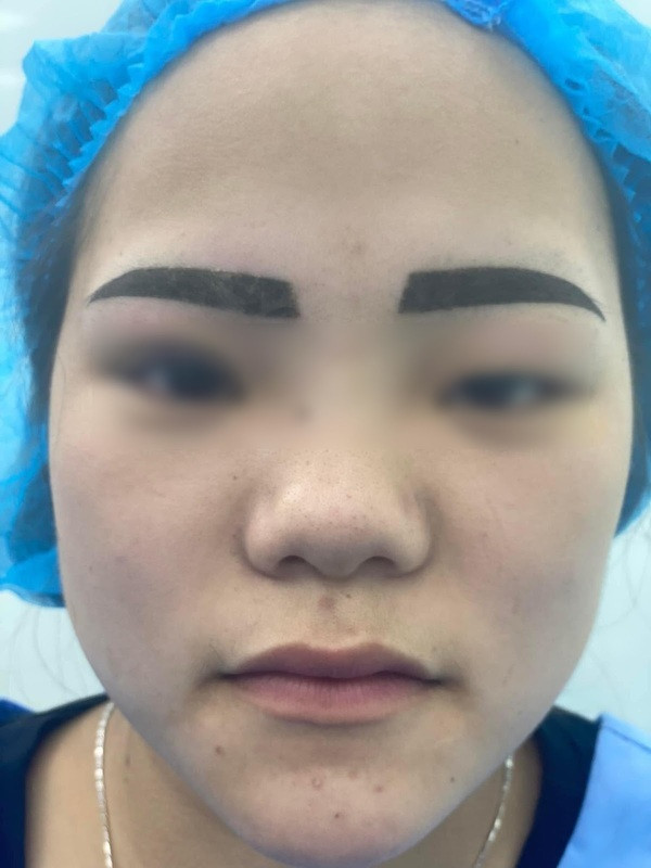 Chưa hết, mực xăm dù đã bong ra nhưng vẫn còn rất đậm, màu mực cũng không được tự nhiên.