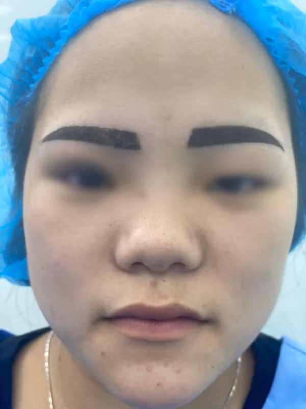 Chưa hết, mực xăm dù đã bong ra nhưng vẫn còn rất đậm, màu mực cũng không được tự nhiên.