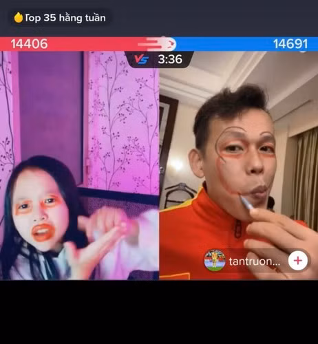 Bên cạnh đó, Bùi Tấn Trường còn tiết lộ mỗi buổi live, anh được mọi người donate tầm hơn 30 đô (gần 1 triệu đồng).