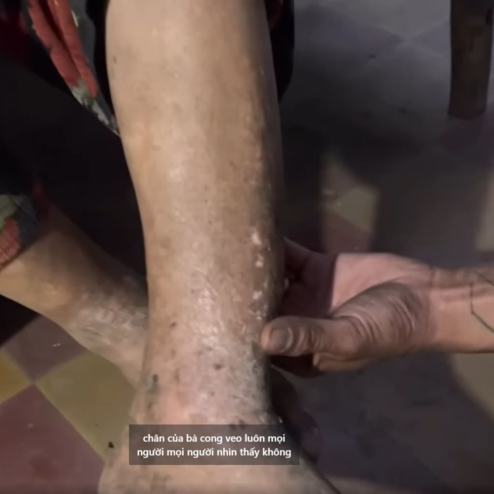 Cụ thể, trên trang cá nhân Lộc Fuho đã đăng tải đoạn video tới nhà cụ bà 85 tuổi để sửa nhà. Cụ bà có hoàn cảnh khó khăn, con cái 3 người đều không khỏe mạnh. Trong khi đó, bà không thể nói, căn nhà dột nát từng khoảng to trên mái. Với tình trạng này, nếu trời mưa thì nhà sẽ bị ướt hết khi nước tràn vào.