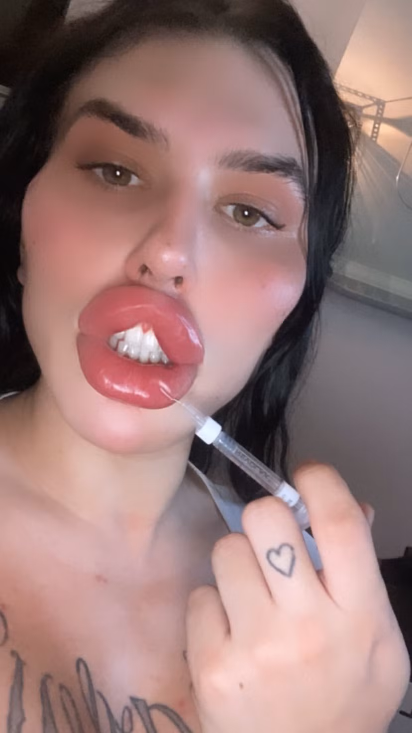 Nói về đôi môi của mình, Sofia giải thích: “Đôi môi của tôi to và đầy đặn nhất từ trước đến nay. Tôi tiêm vào môi hai tháng một lần và đã chi 50.000 bảng Anh (1,4 tỷ đồng) cho riêng đôi môi của mình. Tôi được Kỷ lục Guinness Thế giới tiếp cận để tới Milan vào năm 2024 để công bố chính thức”.