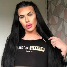 Sofia nói thêm rằng, có rất nhiều người hâm mộ yêu cầu cô quay lại quá trình tiêm chất làm đầy và họ trả tiền để cô làm việc đó.