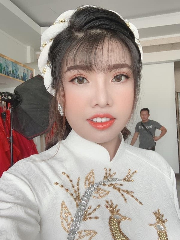 Không cam chịu số phận, Quách Phượng "móc hầu bao" hàng trăm triệu đồng để "đập đi xây lại" toàn bộ gương mặt.