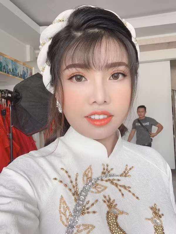 Không cam chịu số phận, Quách Phượng "móc hầu bao" hàng trăm triệu đồng để "đập đi xây lại" toàn bộ gương mặt.