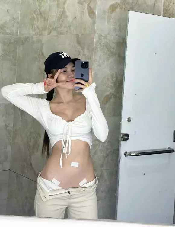 Mới đây, Yến Xuân bạn gái Đặng Văn Lâm gây chú ý khi đăng tải hình ảnh có 3 vết thương ở bụng.