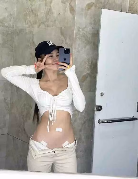 Mới đây, Yến Xuân bạn gái Đặng Văn Lâm gây chú ý khi đăng tải hình ảnh có 3 vết thương ở bụng.